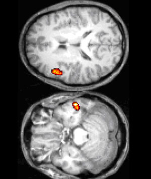 Cerebro con ansiedad 'interna' (arriba) y 'externa' (abajo). (Cortesa de G. A. Miller)