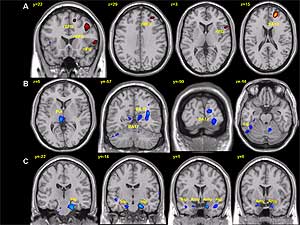 Áreas del córtex cerebral (iluminadas) involucradas con la conducta (fila A), con la función visual (fila B) y con el proceso de memorial emocional (fila C). (Foto: © Science)
