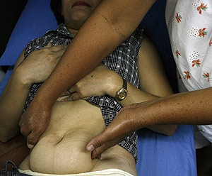 Minda, una matrona tradicional, demuestra la tcnica de masaje que emplea para provocar abortos. (Foto: Cheryl Ravelo | Reuters)