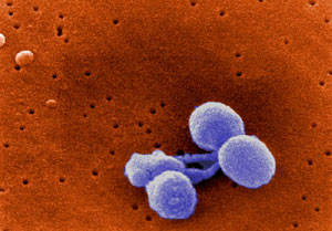 Una imagen de 'Streptococcus pneumoniae'. (Foto: CDC)
