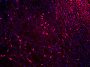 Clulas nerviosas obtenidas por los investigadores nipones. (Shinya Yamanaka | AP)