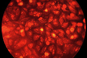 Clulas infectadas por Chlamydia trachomatis. (Foto: CDC)