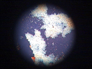 SEVI, en su forma amiloidea, visto con un microscopio. (Foto: CSIC)