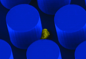 Una clula cancerosa se adhiere a uno de los orificios del chip (Foto: H. Massachusetts)