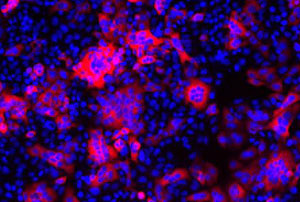 El VIH (en rojo) infecta las células del sistema inmune (azul). (Foto: Abraham Brass)