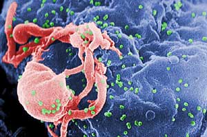 El virus del VIH se topa con linfocitos en cultivo (Foto: Nature Immunology)