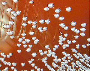 Imagen de la bacteria 'Burkholderia' en cultivo (Foto: CDC)