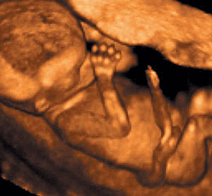 Vista de un feto de 12 semanas por una ecografía de cuatro dimensiones (Foto: El Mundo)