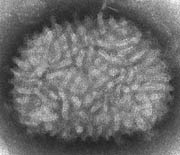 'Vaccinia virus'. (Foto: CDC)