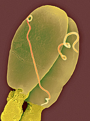 Dos espermatozoides infectados. (Foto: Dennis Kunkel)