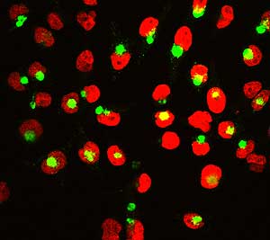 Imagen del compuesto unido a la membrana celular que bloquea la accin de la enzima responsable del Alzheimer. (Foto: Cortesa de Lawrence Rajendran, Dresden, Germany)