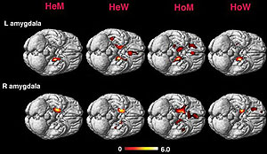La imagen muestra las diferencias entre el cerebro de personas homo y heterosexuales. (Foto: PNAS)