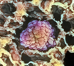 Imagen de una célula tumoral al microscopio (Foto: Science Photo Library)