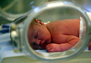 A menudo, el bajo peso del recin nacido est asociado con la prematuridad. (Foto: Eddy Kelele)