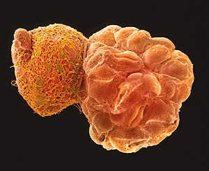 Imagen microcpica de un embrin humano, cinco das depus de su concepcin (Foto: Agefotostock)