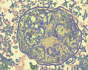 Imagen del virus del sida en un microscopio electrónico. (Foto: Mike Agliolo)