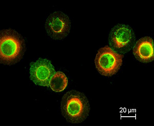 Células epiteliales de la paciente (Foto: Lancet)