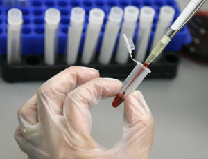 Un técnico de laboratorio examina una muestra de sangre para detectar el VIH (Reuters)