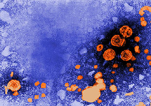 Partculas del virus de la hepatitis B (Foto: CDC | Erskine Palmer)