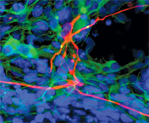 Neuronas motoras y glia obtenidas de células reprogramadas. (Foto: Science)