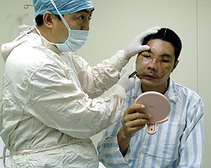 Un mdico examina a Li en abril de 2006 (AFP)