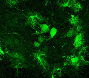 Neuronas motoras marcadas gracias a AAV9. (Foto: 'Nature Biotechnology')