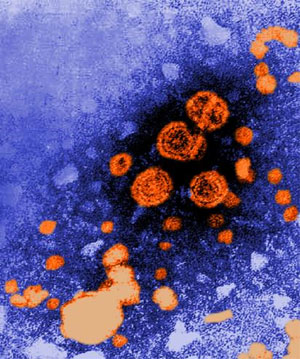Virus de la hepatitis B. (Foto: CDC)