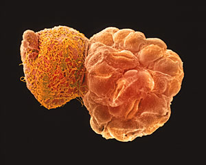 Imagen microcpica de un embrin humano, cinco das despus de su concepcin (Foto: Agefotostock)
