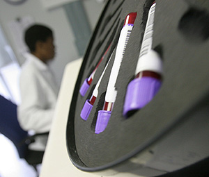 Muestras de sangre en un laboratorio (Foto: AP | Denis Farrell)