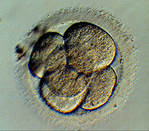 Embrin humano en una clnica reproductiva britnica (Foto: AP)