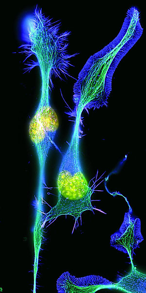 Imagen de una neurona. (Foto: COSMOCAIXA)