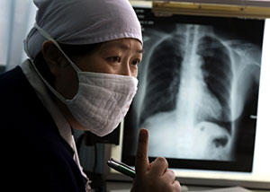 Un mdico del Hospital de Pekn habla con un paciente sospechoso de tener tuberculosis (Foto: Ng Han Guan | AP)