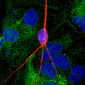 Una neurona funcional con el axn teido de rojo. (Foto: Universidad de California, Davis)