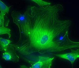 Clulas musculares derivadas de clulas madre embrionarias. (Foto: Reuters)