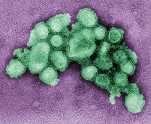 El virus A/H1N1. (Foto: C. S. Goldsmith y A. Balish, CDC)