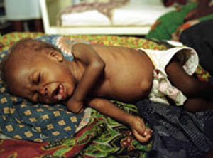 Un beb con diarrea en el hospital de Maputo (Mozambique). (Foto: AP)
