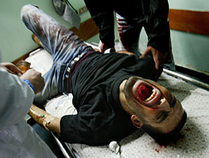 Un hombre palestino grita de dolor por las heridas en su cuerpo. (Foto: AP | Kevin Frayer)