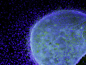 Vista microscpica de una clula madre embrionaria. (Foto: Reuters)