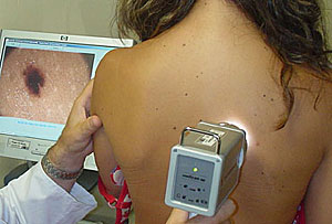 Una paciente se somete a una prueba de cncer de piel. (Foto: El Mundo)