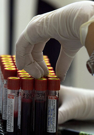 Una muestra de sangre de una prueba gratuita de deteccin del VIH. (Foto: scar Rivera | EFE)