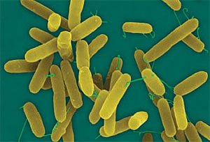 Bacteria 'Pseudomona aeruginosa'. (Foto: Dennis Kunkel Microscopy | Science)