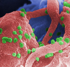 El VIH uniéndose a un linfocito. (CDC)