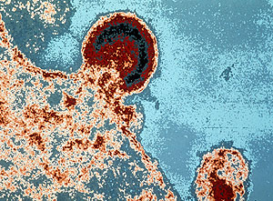 Virus del VIH infectando un linfocito (Foto: AFP | Instituto Pasteur)