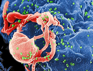 Las clulas CD4 son un tipo de linfocito. En la imagen, el virus VIH unindose a un linfocito. (Ilustracin: El Mundo)