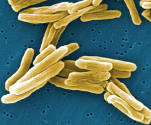 Bacteria de la tuberculosis. (Foto: CDC)