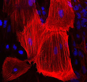 Clulas madre obtenidas del cordn umbilical. (Foto: Juan Carlos Izpisa | Cell Stem Cell)