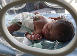 Un recin nacido en una incubadora. (Foto: Joe Shalmoni | Reuters)