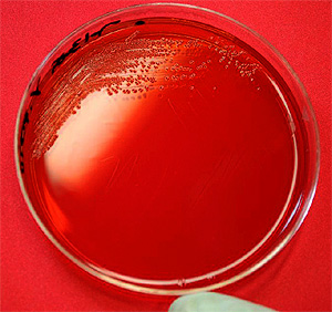 Un cientfico trabaja con una placa de Petri (Foto: CDC)