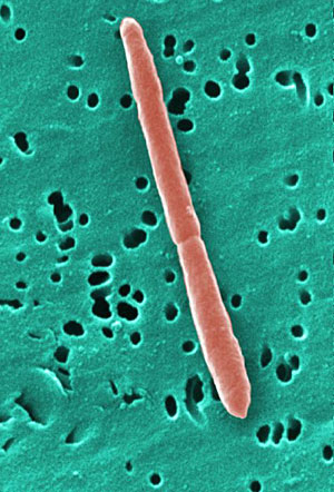 'Bacteroides termitidis', uno de los microbios que viven en el instestino humano. (Foto: Brian J. Beck | CDC)