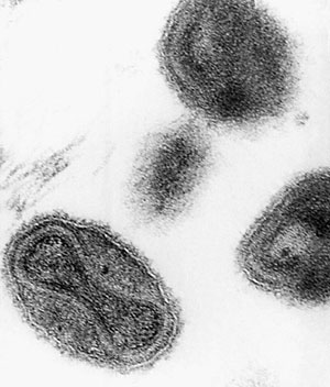 Vista al microscopio del virus de la viruela. (Foto: El Mundo)